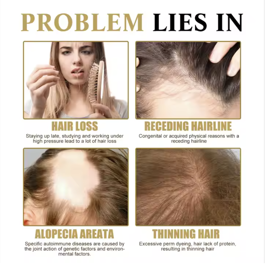 Miniatura 11 de ESENCIA CAPILAR ANTI CALVICIE